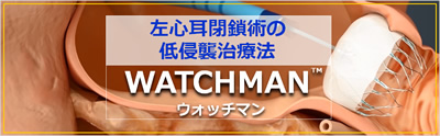 左心耳閉鎖術の低侵襲治療法ウォッチマン