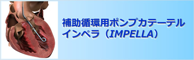 補助循環用ポンプカテーテル「インペラ