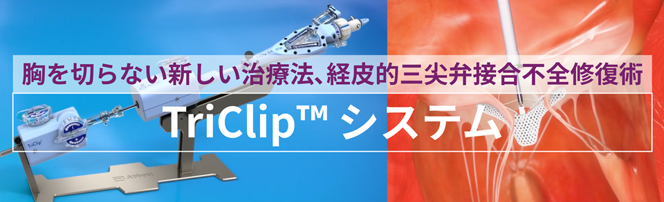 TriCli™システム　経皮的三尖弁接合不全修復術